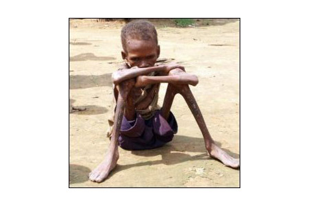 Hunger